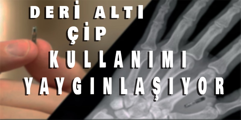 Deri altı çip kullanımı yaygınlaşıyor