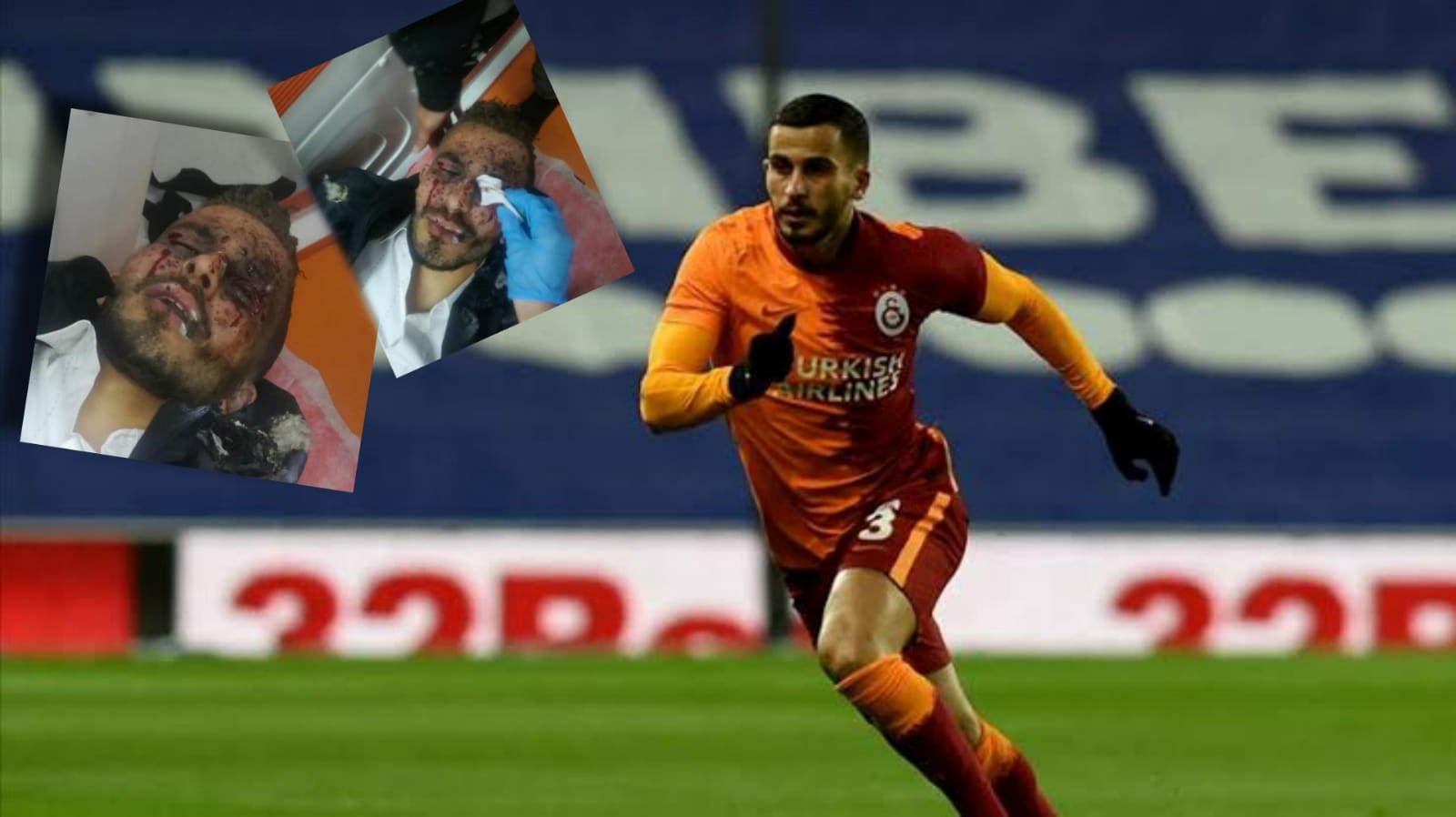 Galatasaray'ın yıldız futbolcusu Omar'ın elinde havai fişek patladı, gözleri tehlikede