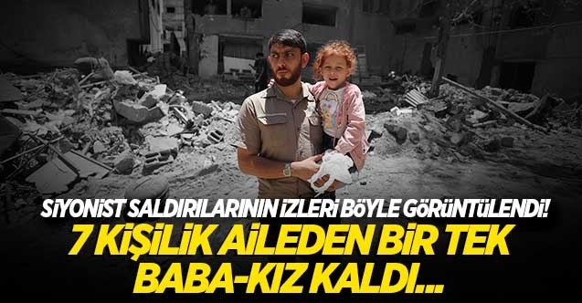 Siyonistlerin saldırılarında 7 kişilik aileden bir tek Baba-kız kaldı