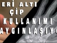 Deri altı çip kullanımı yaygınlaşıyor